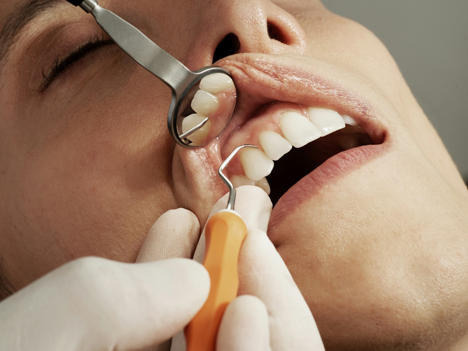 The Dental Insurance Trap Nobody Warned Me About
